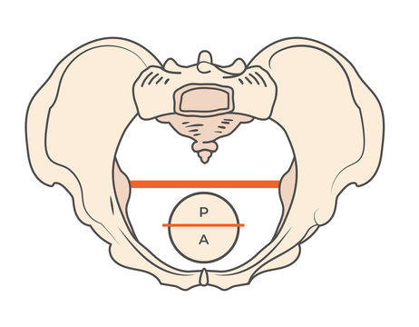 Gynecoid Pelvis Shape with Round / Circular shape