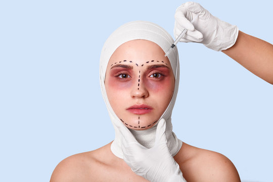Photo of girl with inflamed bruised skin, with bandage, recieves injection from nurse, wants to see new face in mirror, stands against blue background. Medical treatment and cosmetic surgery concept.