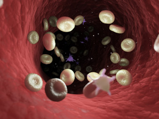 3d rendered medically accurate illustration of diseased blood cells