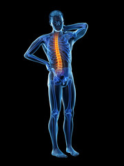 3d rendered medically accurate illustration of a man having a backache