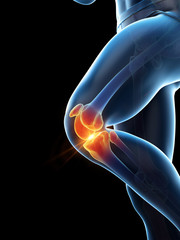 3d rendered medically accurate illustration of a painful knee