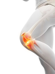 3d rendered medically accurate illustration of a painful knee