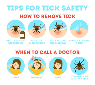 Tips for tick safety infographic. How to remove mite