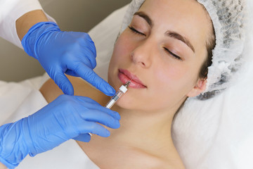 Aesthetic cosmetology. Hands of a cosmetologist inject hyaluronic acid into girl’s upper lip. Lip augmentation in spa salon