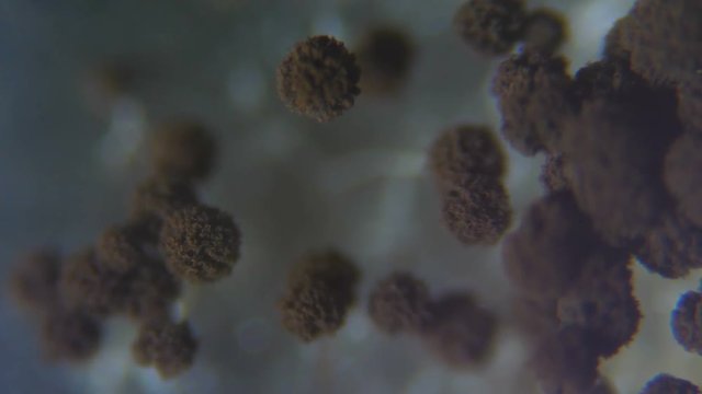 Mold under the microscope. GMO. DNA. Black Mold taken from rotten bread , under a microscope. Colony of mold with spores on a bread crust. Allergy, poisoning, fungus.
