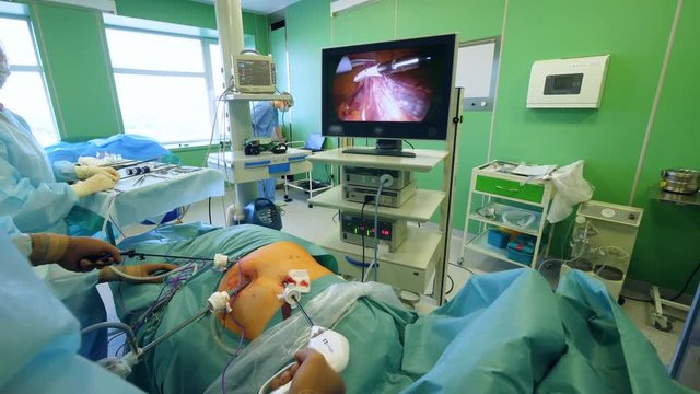 Surgery is being held and displayed on a screen