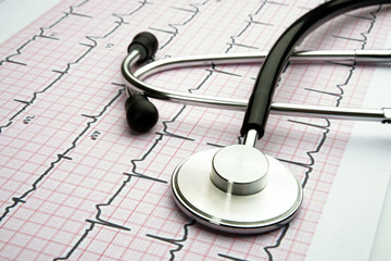 stethoscope on a cardiogram