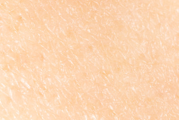 Human skin as a background.