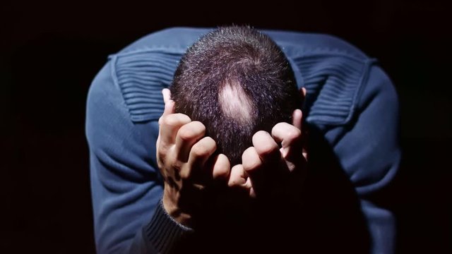 Thoughtful man with bald patches on his head