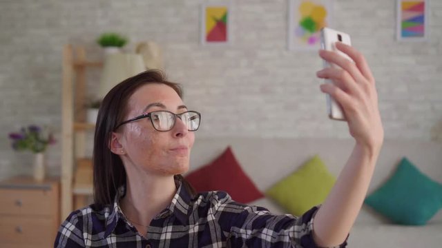 Close up young woman with a scar from a burn on her face takes a selfie