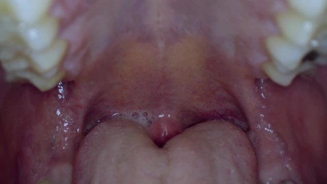 	man's throat from the inside close up