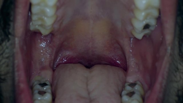 	man's throat from the inside close up
