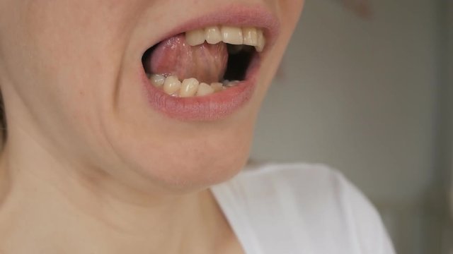 Close-up of the face of an adult woman examining a missing tooth in her mouth.