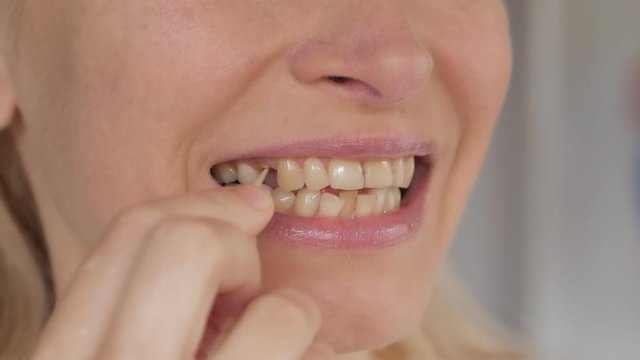 Close-up of the face of an adult woman examining a missing tooth in her mouth.