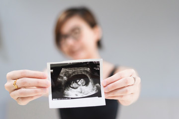 Young pregnant woman looking at 12 Weeks x-ray ultrasound scan of baby