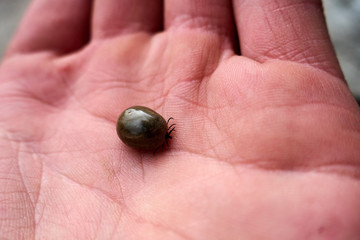 Tick maximum filled with blood sitting on human skin ,