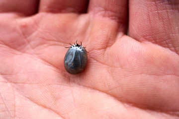 Tick maximum filled with blood sitting on human skin ,