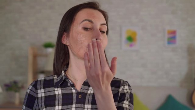 Close up young woman puts cream on a scar from a burn on her face