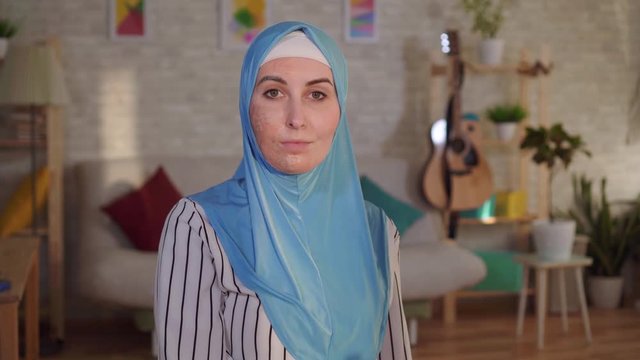Young arab woman in a hijab with a burn scar on her face