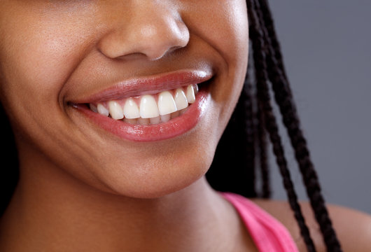 Close up of white teeth on smiling woman