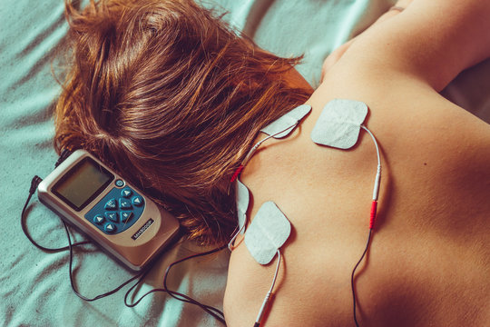 Small electro stimulator and electrodes placed on a woman&rsquo;s back &ndash; Electric medical device used in alternative therapies &ndash; Concept image for pain relief and relaxing massage