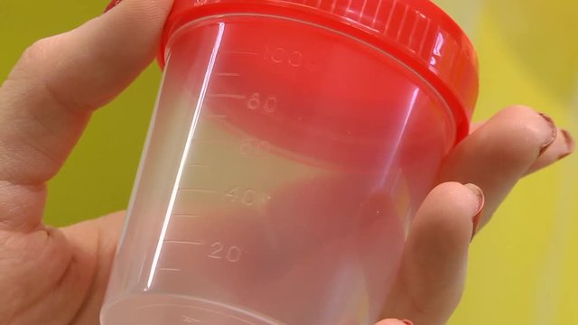 The concept of artificial insemination, Infertility treatment. Medical concept. The doctor's hand is holding a jar of analyzes.