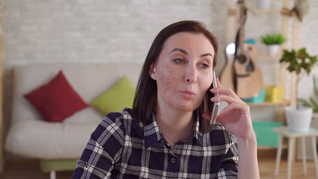 Portrait young woman with a burn scar on her face talking on the phone
