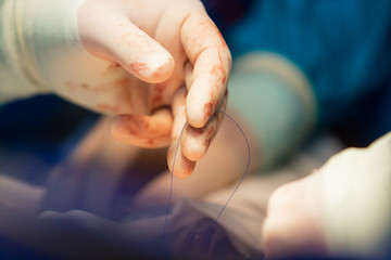 Surgical team operating a patient in an operation theater. Surgeon at work in the hospital....