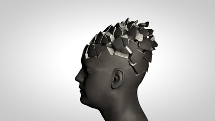 Alzheimer's disease or memory loss