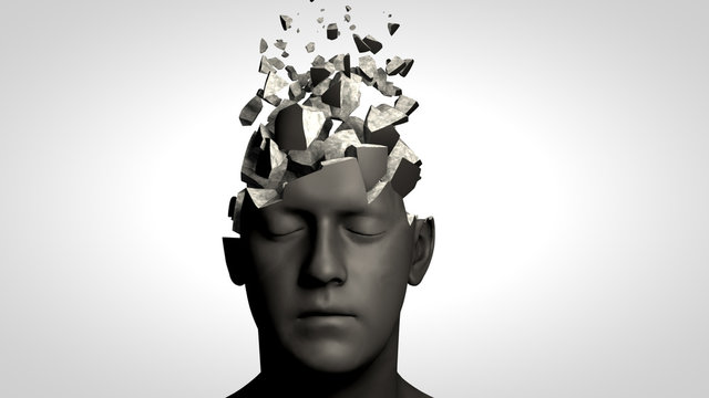 Alzheimer's disease or memory loss