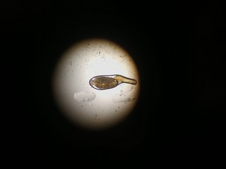 NIT in the microscope alive