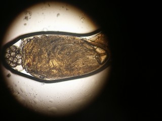 NIT in the microscope alive