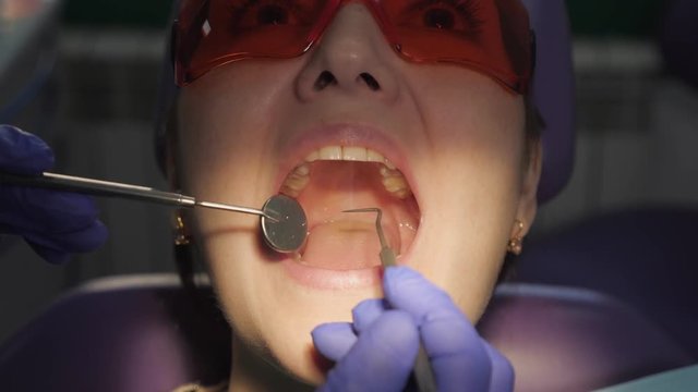 Dentist examines patient's tooth with black cavity on it using dental tools and mirror. Tooth decay in opening mouth closeup.