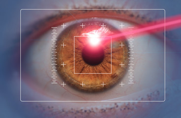 laser eye surgery concept close up of eye with laser beam