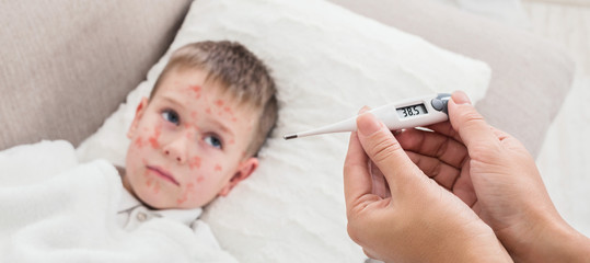 High Fever Measles Virus. Mother Measuring Temperature Of Son - obrazy, fototapety, plakaty