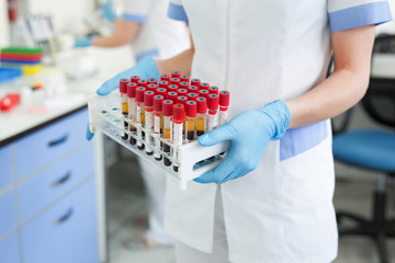 Hands of a lab technician holding a rack of color test tubes with blood samples of other patients.