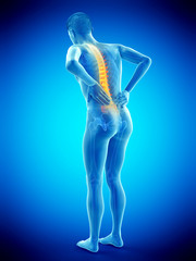 3d rendered medically accurate illustration of a man having acute back pain