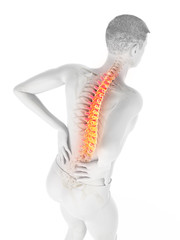3d rendered medically accurate illustration of a man having acute back pain
