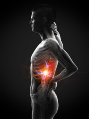 3d rendered medically accurate illustration of a man having acute back pain