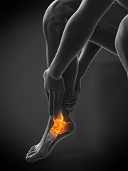 3d rendered medically accurate illustration of a painful ankle