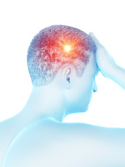 3d rendered medically accurate illustration of a man having a migraine