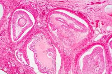 Light microscopic of human ovary showing primary and secondary follicles.