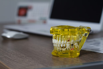 The dental tooth dentistry student learning teaching model showing teeth, roots, gums, gum disease