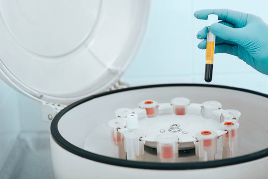 Blood samples in vials on a centrifuge machine close-up