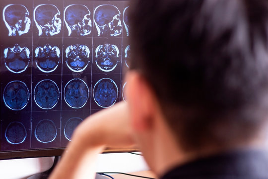 Doctor Radiologist In Hospital Looking At X-ray Mri Scan Of Brain, Head And Skull Ct Scanning On Digital Computer Screen