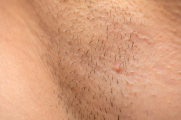 Unshaved armpit close up