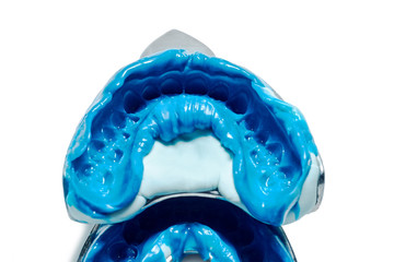 Two dental impressions on a white background with copy space. © baklykovadaria