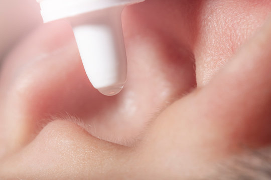 Medical Pipette With A Drop Of Medication Over The Patient's Ear