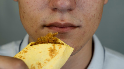 Teenager with pimples and acne on face is eating junk food, close up