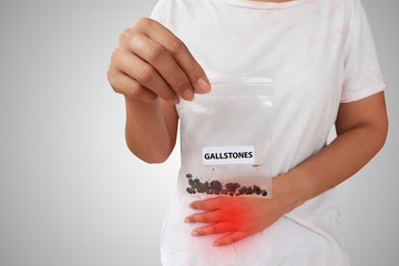 female with gallstones.